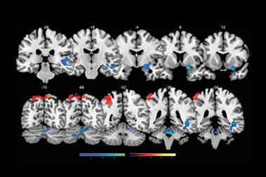 brain_activity