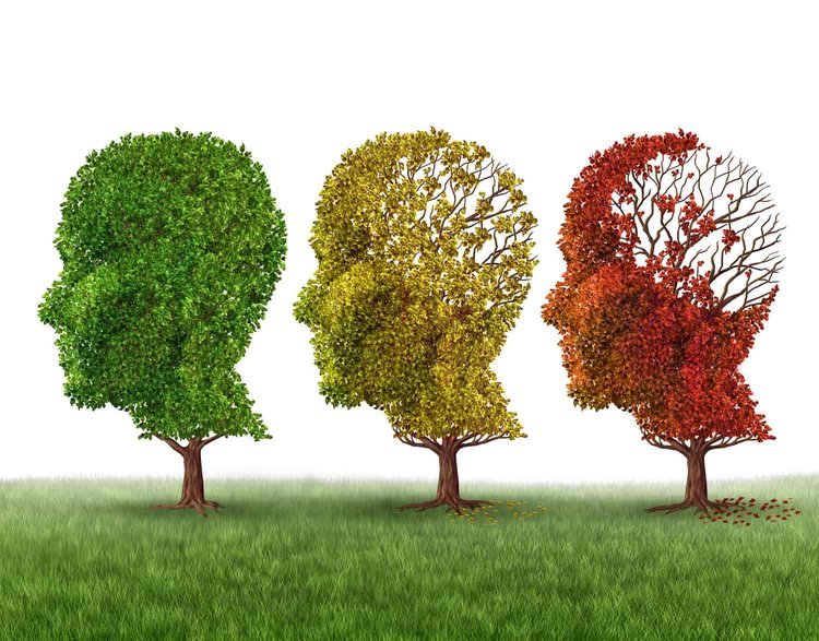 With Alzheimer’s Treatment Stalled, Promising Pipeline Treatments And A Shift In Perception Could Be Key To Tackling The Disease